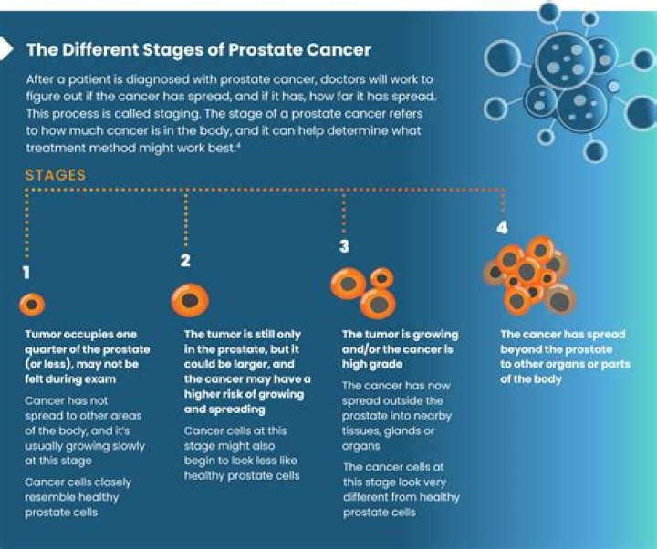 Groundbreaking Insights For Prostate Cancer